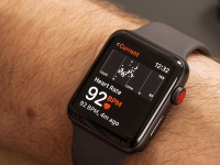 Годинник Apple Watch врятував чергове життя, причому цього разу він допоміг діагностувати пухлину.