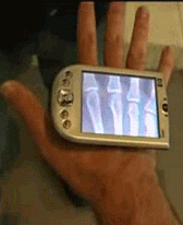 Portable X-Ray
